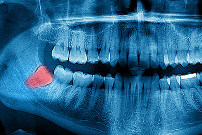 Forever Smiles Dental Offer